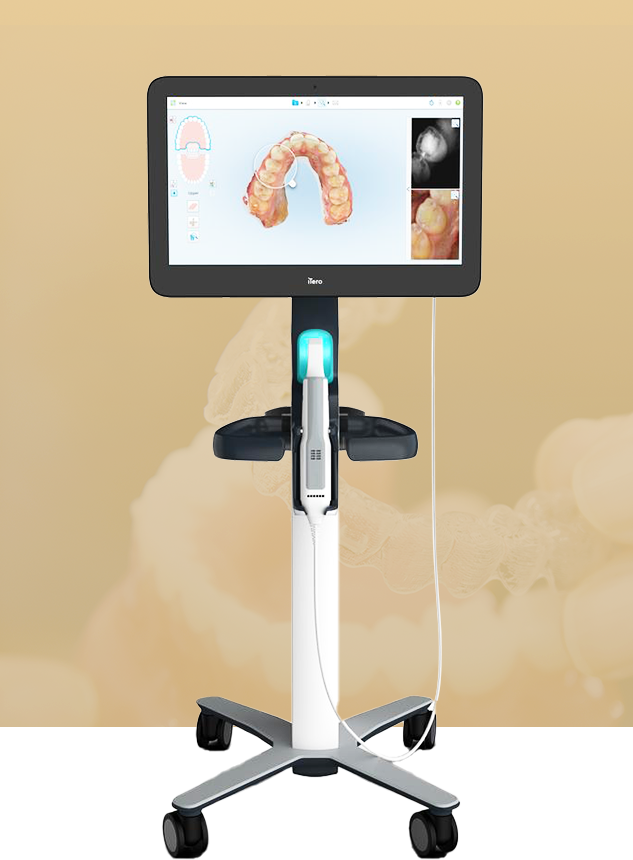 精度の高い治療のための医療機器iTero(アイテロ)を導入しています